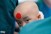 Thưởng ê-kíp phẫu thuật cặp song sinh dính liền Thưởng ê-kíp phẫu thuật cặp song sinh dính liền