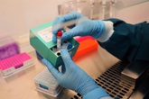 Vinmec phát triển thành công 02 bộ kit phát hiện và chẩn đoán virus Sars-Cov-2 Vinmec phát triển thành công 02 bộ kit phát hiện và chẩn đoán virus Sars-Cov-2