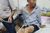 Khởi tố 2 đối tượng dùng dao chém công an nhập viện Khởi tố 2 đối tượng dùng dao chém công an nhập viện