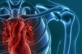 Bé 5 tháng tuổi viêm phổi kéo dài vì dị tật ở tim Bé 5 tháng tuổi viêm phổi kéo dài vì dị tật ở tim