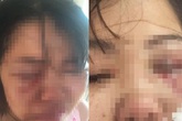 Chỉ vì muốn ly hôn, người phụ nữ bị chồng đánh đập dã man Chỉ vì muốn ly hôn, người phụ nữ bị chồng đánh đập dã man