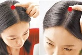 Cơ thể con người có 5 "công tắc" để mọc tóc, hãy bấm mỗi ngày để ngăn rụng tóc và tạm biệt hói đầu Cơ thể con người có 5 "công tắc" để mọc tóc, hãy bấm mỗi ngày để ngăn rụng tóc và tạm biệt hói đầu