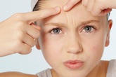 Mụn trứng cá mọc to chình ình trên mặt vì cứ ăn thả phanh loại thực phẩm ngon miệng này Mụn trứng cá mọc to chình ình trên mặt vì cứ ăn thả phanh loại thực phẩm ngon miệng này