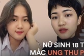 Nữ sinh 18 tuổi mắc ung thư phổi: "Một ngày đứng trước gương, chỉ vuốt tóc 15 phút nhưng mình trọc cả mái đầu" Nữ sinh 18 tuổi mắc ung thư phổi: "Một ngày đứng trước gương, chỉ vuốt tóc 15 phút nhưng mình trọc cả mái đầu"
