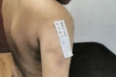 Gửi con cho cô giáo thân thiết dạy kèm, mẹ đâu ngờ "giao trứng cho ác" khi biết con bị đánh 1500 roi khiến 1/4 cơ thể tổn thương Gửi con cho cô giáo thân thiết dạy kèm, mẹ đâu ngờ "giao trứng cho ác" khi biết con bị đánh 1500 roi khiến 1/4 cơ thể tổn thương