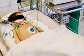 Bé sơ sinh bị chảy máu não Bé sơ sinh bị chảy máu não