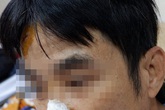 Người đàn ông bị chó becgie tấn công Người đàn ông bị chó becgie tấn công