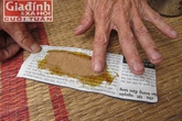 Tấm lòng thiện của lương y gần 50 năm nối xương cho hàng nghìn bệnh nhân bằng bài thuốc gia truyền kỳ diệu Tấm lòng thiện của lương y gần 50 năm nối xương cho hàng nghìn bệnh nhân bằng bài thuốc gia truyền kỳ diệu