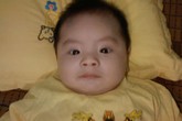 Bé 3 tuổi chống chọi với ung thư máu Bé 3 tuổi chống chọi với ung thư máu