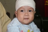 Xót xa những vết loét ngày càng sâu trên đầu bé Vũ Mạnh Tùng Xót xa những vết loét ngày càng sâu trên đầu bé Vũ Mạnh Tùng