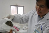 Những ca tai nạn “lột” da đầu hi hữu Những ca tai nạn “lột” da đầu hi hữu