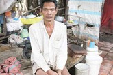 Cuộc sống đói nghèo, lầm lũi của những "dị nhân" Cuộc sống đói nghèo, lầm lũi của những "dị nhân"