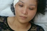 Hải Phòng: Súng công an xã cướp cò làm bạn gái bị thương Hải Phòng: Súng công an xã cướp cò làm bạn gái bị thương