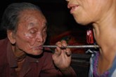 Bí hiểm thuật dùng ống "hút" bệnh của kỳ nhân 108 tuổi Bí hiểm thuật dùng ống "hút" bệnh của kỳ nhân 108 tuổi
