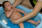 Chớ chủ quan khi trẻ hẹp bao quy đầu Chớ chủ quan khi trẻ hẹp bao quy đầu