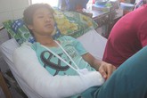 Hỗn chiến, một thanh niên bị cắt đứt 2/3 lưỡi Hỗn chiến, một thanh niên bị cắt đứt 2/3 lưỡi