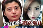 Cô nàng mặt tròn thành "hot girl" sau khi gọt mặt gây sốt Cô nàng mặt tròn thành "hot girl" sau khi gọt mặt gây sốt