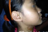 Rợn người nghe bé gái kể bị bố và dì ghẻ đánh, vứt ra nghĩa địa Rợn người nghe bé gái kể bị bố và dì ghẻ đánh, vứt ra nghĩa địa