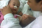 2 bé sơ sinh dính tim: Sinh con 11 tháng, bế con được 1 giờ 2 bé sơ sinh dính tim: Sinh con 11 tháng, bế con được 1 giờ