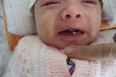 Những đồn đại quanh bé mới sinh đã mọc răng cửa Những đồn đại quanh bé mới sinh đã mọc răng cửa