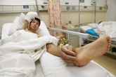 Chàng trai có bàn tay phải "mọc" ở chân Chàng trai có bàn tay phải "mọc" ở chân
