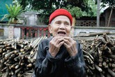 Hà Nội: Cụ ông 90 tuổi mọc lại cả hàm răng Hà Nội: Cụ ông 90 tuổi mọc lại cả hàm răng