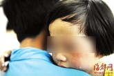 Bé gái 5 tuổi mắc bệnh lậu sau khi bị lạm dụng tình dục Bé gái 5 tuổi mắc bệnh lậu sau khi bị lạm dụng tình dục