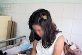 Thiếu nữ 9X bị rạch mặt vì khuyên đàn em bỏ chơi Thiếu nữ 9X bị rạch mặt vì khuyên đàn em bỏ chơi