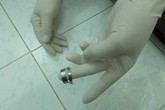Suýt mất “của quý” vì đeo nhẫn không đúng chỗ Suýt mất “của quý” vì đeo nhẫn không đúng chỗ