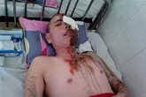 Tạt axit 5 người vì bị ngăn cản tình yêu với cô bé... 10 tuổi Tạt axit 5 người vì bị ngăn cản tình yêu với cô bé... 10 tuổi