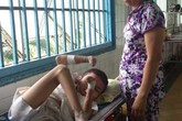 Gia cảnh éo le của chàng trai rụng dần tứ chi Gia cảnh éo le của chàng trai rụng dần tứ chi
