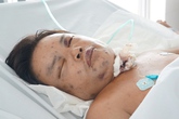 Bắt ong kiếm tiền mua sách cho con, bị ong đốt nguy kịch Bắt ong kiếm tiền mua sách cho con, bị ong đốt nguy kịch