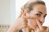 Đừng để bị mụn do căng thẳng! Đừng để bị mụn do căng thẳng!