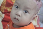 Xót xa khuôn mặt ngày càng tím tái của bé Vũ Mạnh Tùng Xót xa khuôn mặt ngày càng tím tái của bé Vũ Mạnh Tùng