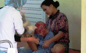 Ánh mắt mòn mỏi của đứa bé bị lột da đầu vì tai nạn Ánh mắt mòn mỏi của đứa bé bị lột da đầu vì tai nạn