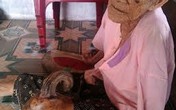 Giải mã hiện tượng người... mọc sừng Giải mã hiện tượng người... mọc sừng
