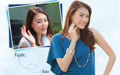 Làm mờ sẹo lồi không khó như bạn nghĩ Làm mờ sẹo lồi không khó như bạn nghĩ