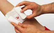 Bị rắn cắn không được ga rô? Bị rắn cắn không được ga rô?
