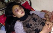 Đưa nữ sinh vào khách sạn rồi đánh hội đồng dã man Đưa nữ sinh vào khách sạn rồi đánh hội đồng dã man