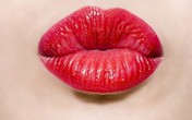 Một nụ hôn, 80 triệu vi khuẩn Một nụ hôn, 80 triệu vi khuẩn