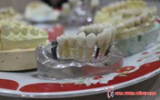 Bọc Răng Sứ Thẩm Mỹ Tại Nha Khoa Đông Nam Bọc Răng Sứ Thẩm Mỹ Tại Nha Khoa Đông Nam