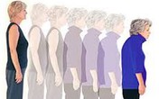 Phụ nữ có thể “lùn” đi 5cm khi về già Phụ nữ có thể “lùn” đi 5cm khi về già
