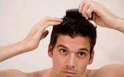 Tìm thấy hy vọng sau 8 năm trường rụng tóc Tìm thấy hy vọng sau 8 năm trường rụng tóc