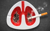 Trao giải tuyên truyền về tác hại của thuốc lá Trao giải tuyên truyền về tác hại của thuốc lá