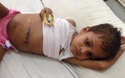 Bé 4 tuổi nhai suốt 9 tháng cuộn tóc dài 1,2m vào bụng Bé 4 tuổi nhai suốt 9 tháng cuộn tóc dài 1,2m vào bụng