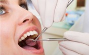 Những điều cần biết khi nhổ răng khôn Những điều cần biết khi nhổ răng khôn