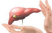 11 bí quyết đơn giản phòng ngừa bệnh gan 11 bí quyết đơn giản phòng ngừa bệnh gan