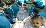 Bé bị đâm xuyên sọ phải phẫu thuật vì nhiễm trùng não Bé bị đâm xuyên sọ phải phẫu thuật vì nhiễm trùng não