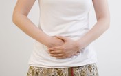 6 điều cần biết về ung thư đại tràng 6 điều cần biết về ung thư đại tràng