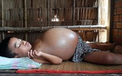 Vòng tay nhân ái: Gần 40 triệu đồng đến với cậu bé bụng to như trống Vòng tay nhân ái: Gần 40 triệu đồng đến với cậu bé bụng to như trống